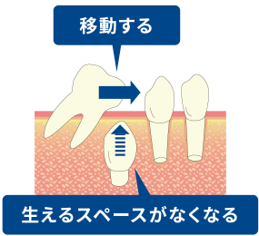 生えるスペースがなくなる